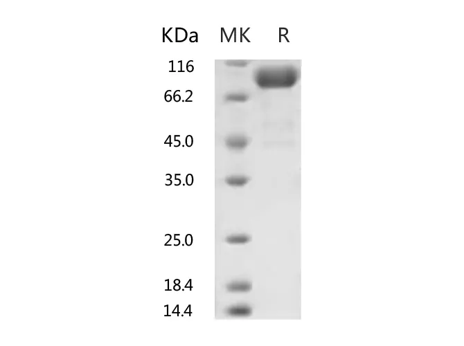 Recombinant Human ACE2 Protein (His Tag) - image 1