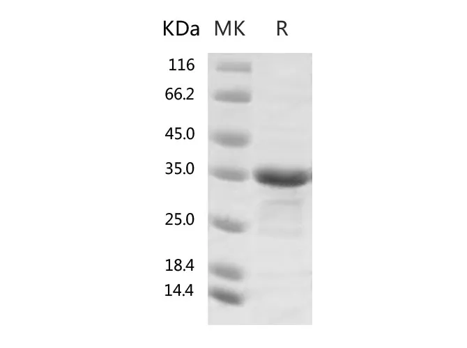 Recombinant SARS-CoV-2 Papain-like Protease Protein (His Tag) - image 1