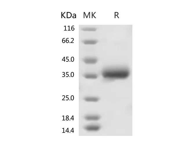 Recombinant SARS-CoV-2 Spike Protein (RBD, His Tag) - image 1