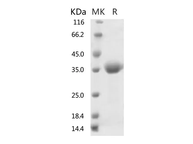 Recombinant SARS-CoV-2 Spike Protein (RBD) - image 1