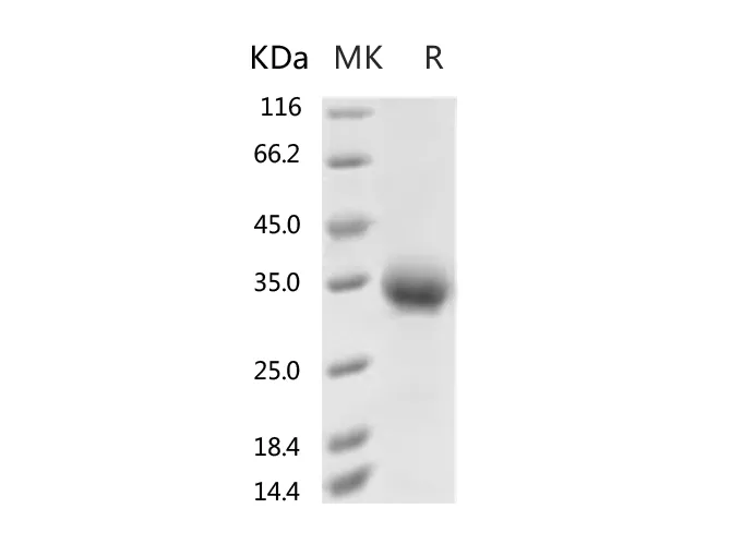 Recombinant SARS-CoV-2 Spike Protein (RBD, His Tag)(V367F) - image 1