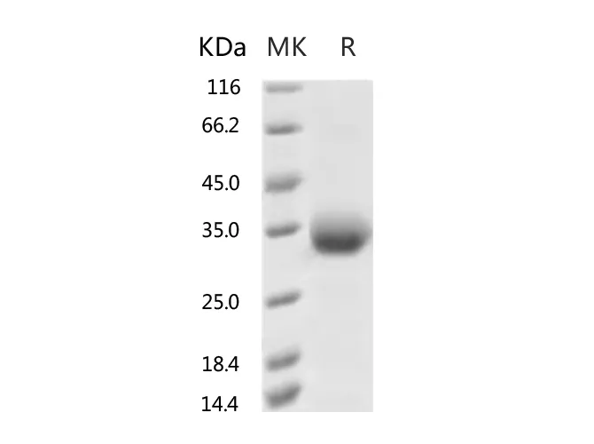 Recombinant SARS-CoV-2 Spike Protein (RBD, His Tag)(V483A) - image 1