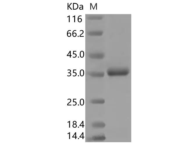 Recombinant SARS-CoV-2 Spike Protein (RBD, His Tag)(G476S) - image 1
