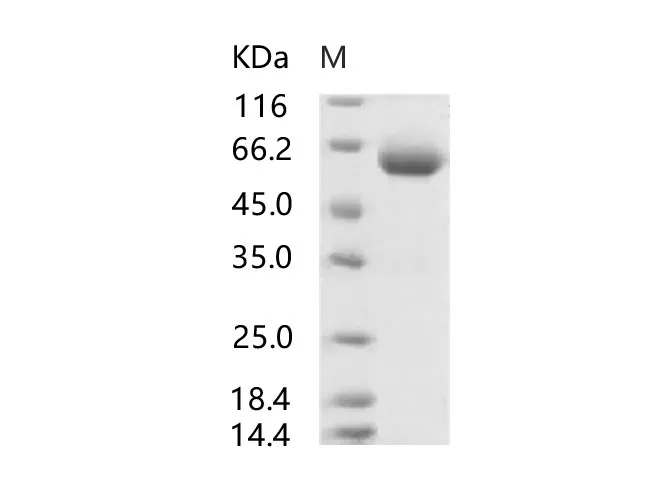 Recombinant SARS-CoV Spike Protein (RBD, mFc Tag) - image 1