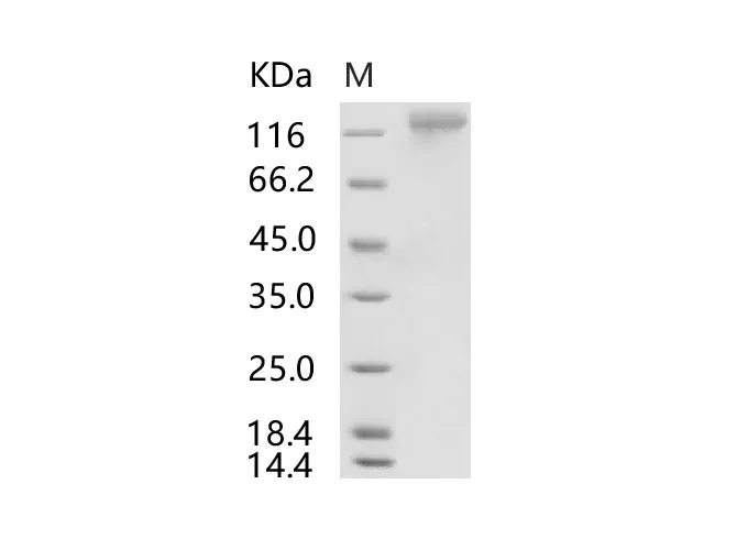 Recombinant HCoV-HKU1 (Isolate N1) S1 Protein (His Tag) - image 1