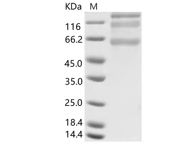 Recombinant HCoV-HKU1 (Isolate N5) S1+S2 Protein (ECD, His Tag) - image 1