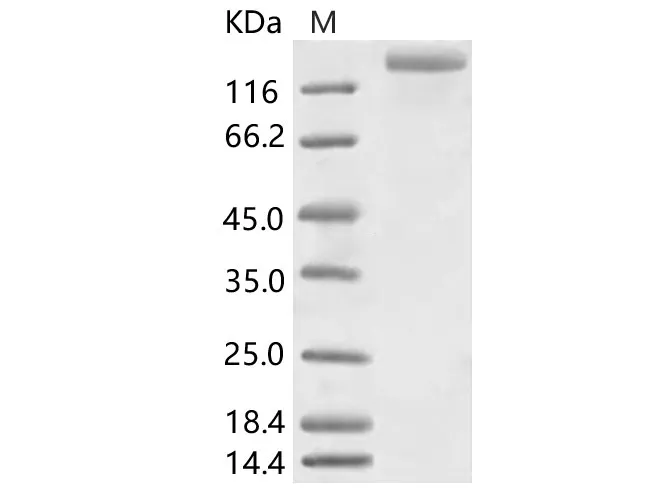 Recombinant HCoV-NL63 S1+S2 Protein (ECD, His Tag) - image 1