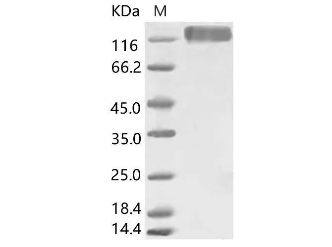 Recombinant HCoV-229E S1+S2 Protein (ECD, His Tag) - image 1