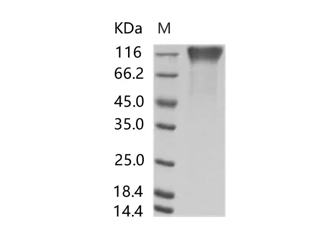 Recombinant EBOV (subtype Sudan, strain Gulu) GP1 / Glycoprotein Protein (His Tag) - image 1