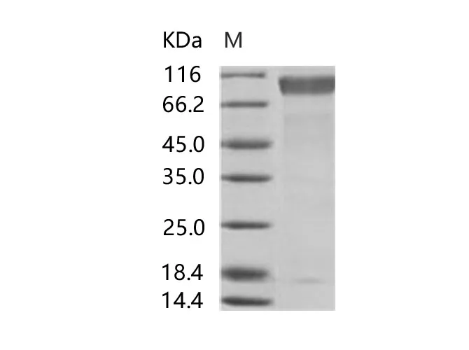 Recombinant EBOV (subtype Sudan, strain Gulu) GP1 / Glycoprotein Protein (His Tag) - image 1