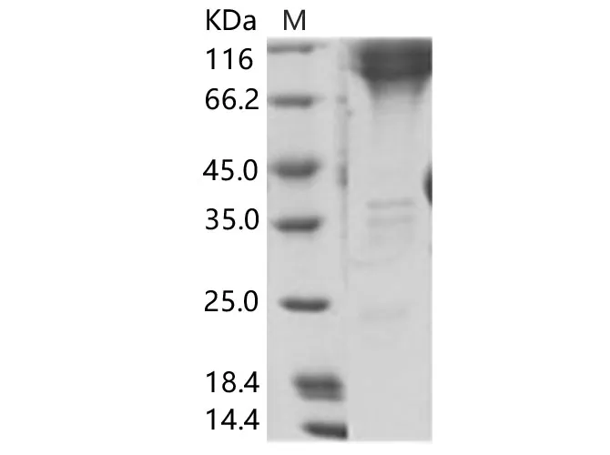 Recombinant EBOV (subtype Zaire, strain H.sapiens-wt/GIN/2014/Kissidougou-C15) GP2 / Glycoprotein Protein (Fc Tag) - image 1