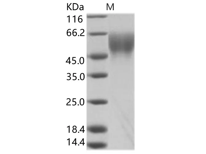 Recombinant EBOV (subtype Zaire, strain Mayinga 1976) GP-RBD / Glycoprotein Protein - image 1