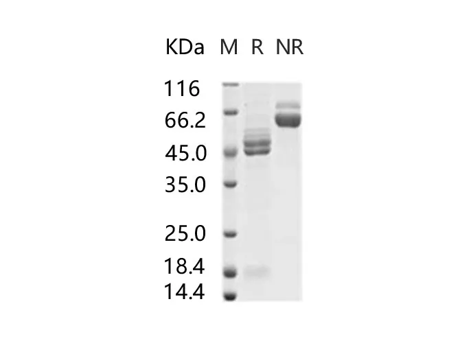 Recombinant RSV (A2) Fusion glycoprotein / RSV-F Protein (His Tag) - image 1