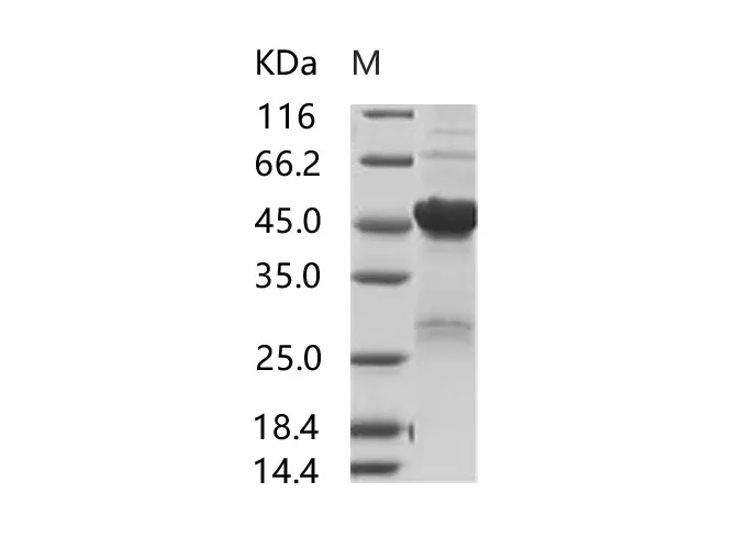 Recombinant SARS-CoV Nucleoprotein / NP Protein (His Tag) - image 1