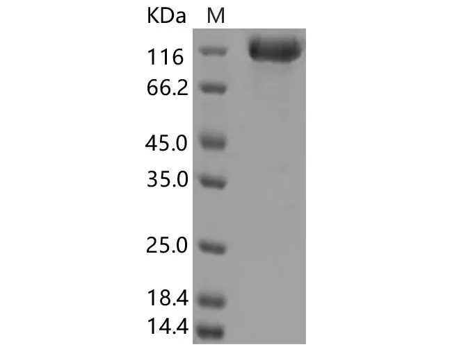 Recombinant SARS-CoV Spike S1+S2 ECD-His Recombinant Protein (S577A, Isolate Tor2) - image 1