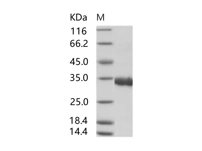 Recombinant SARS-CoV Spike/RBD Protein (RBD, His Tag) - image 1