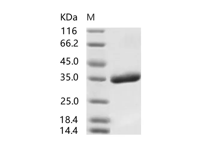 Recombinant SARS-CoV Spike/RBD Protein (RBD, His Tag), Biotinylated - image 1
