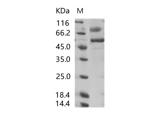 Recombinant SARS-CoV Spike/RBD Protein (RBD, rFc Tag) - image 1