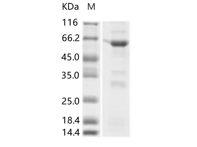 Recombinant ZIKV E / Envelope protein (Domain I, His & MBP Tag) - image 1