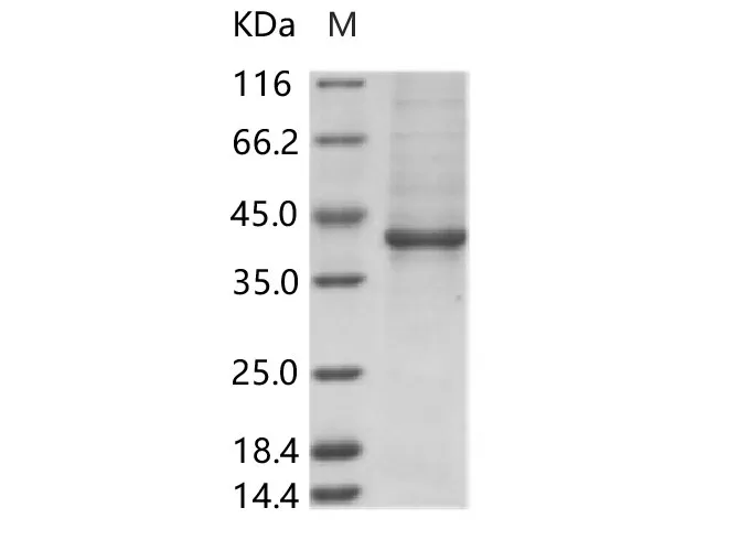 Recombinant ZIKV (strain Zika SPH2015) Envelope protein (Domain III, Fc Tag) - image 1