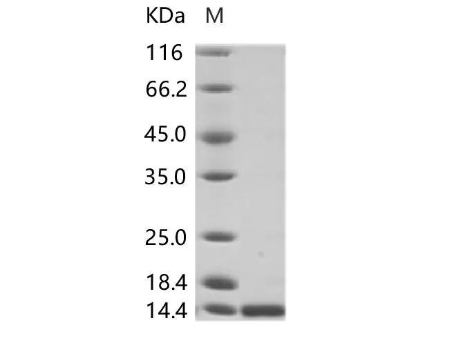 Recombinant ZIKV (strain Zika SPH2015) Envelope protein (Domain III, His Tag) - image 1