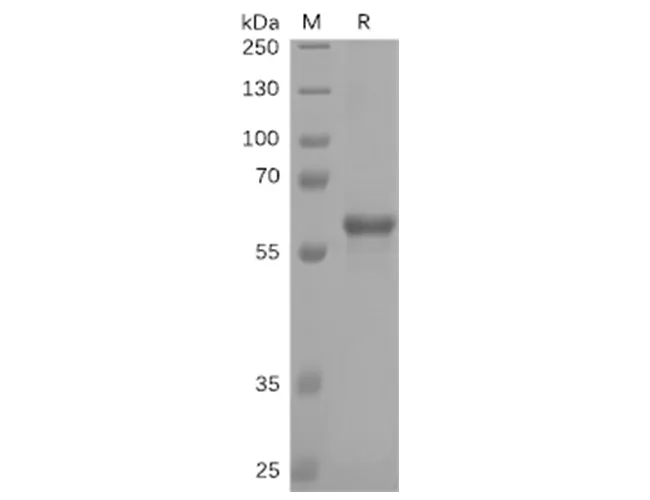 Recombinant SARS-CoV-2 (SARS-CoV-2) S protein RBD (C-mFc-6His tag) - image 1