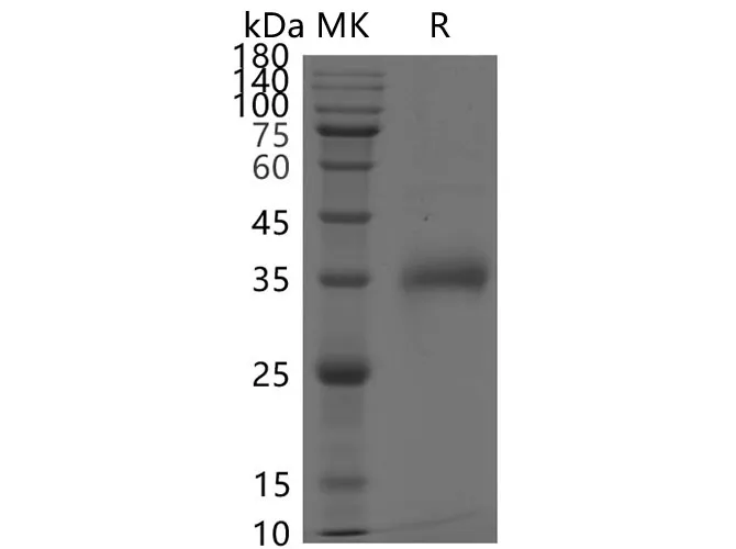 Recombinant SARS-CoV-2 Spike RBD(E484K)(His Tag) - image 1