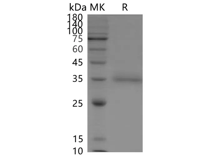 Recombinant SARS-CoV-2 Spike RBD(L452R)(His Tag) - image 1