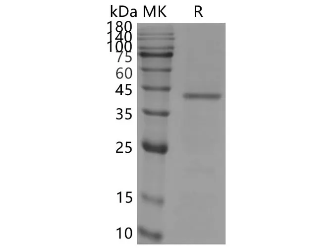Recombinant SARS-CoV-2 S+E+M protein - image 1