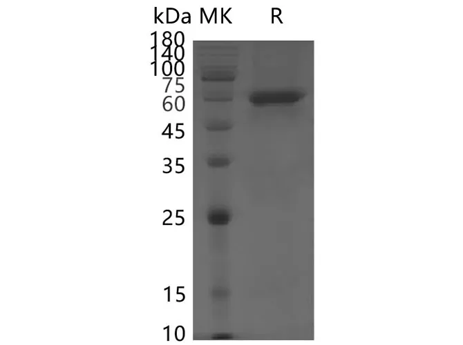 Recombinant SARS-CoV-2 NSP12 protein - image 1