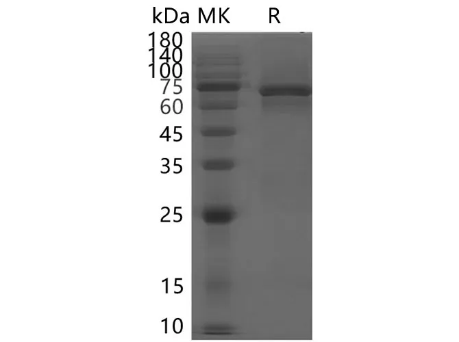 Recombinant SARS-CoV-2 NSP13 protein - image 1