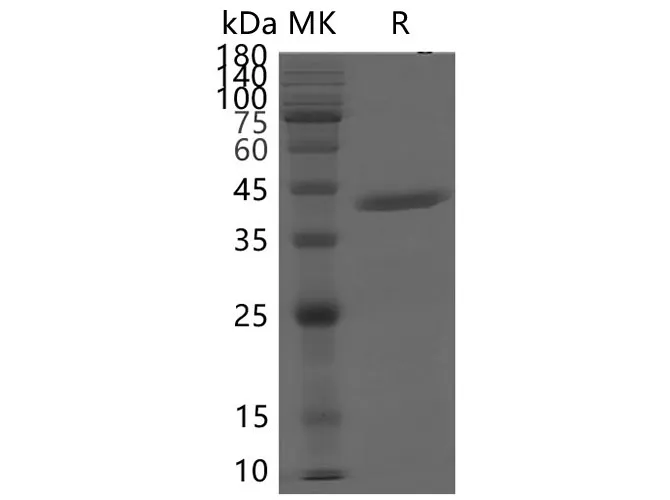 Recombinant SARS-CoV-2 NSP15 protein - image 1