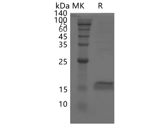 Recombinant SARS-CoV-2 ORF7a protein - image 1