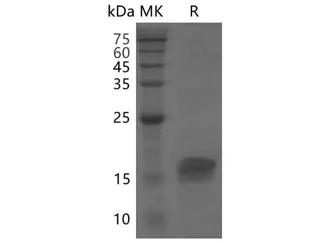 Recombinant SARS-CoV-2 ORF8 protein - image 1