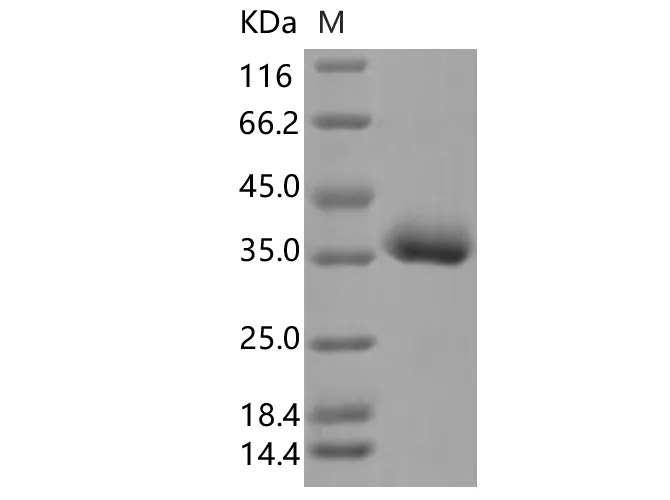 Recombinant SARS-CoV-2 Spike RBD (L452R, E484Q)(His Tag) - image 1