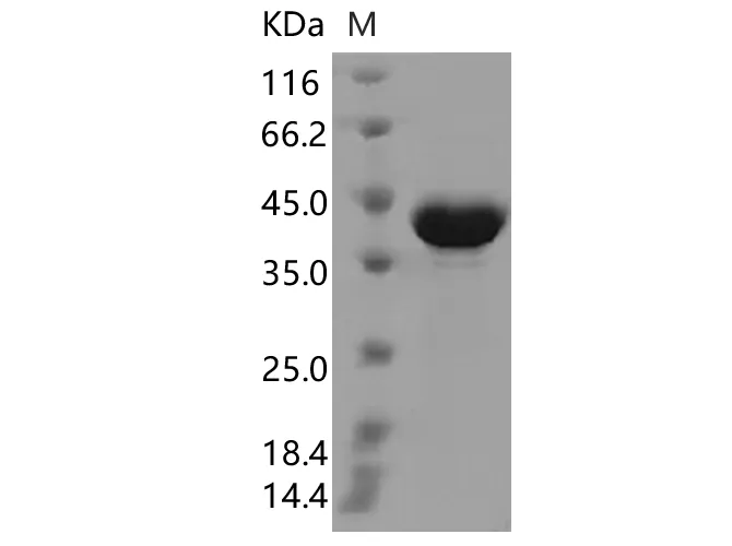 Recombinant SARS-CoV-2 N Protein (T205I)(His Tag) - image 1