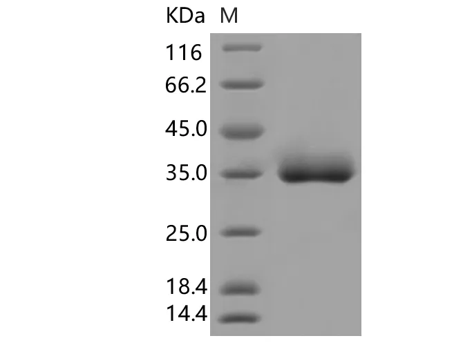 Recombinant SARS-CoV-2 Spike RBD(N501Y)(His Tag) - image 1