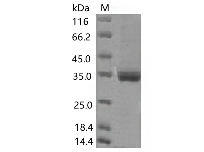 Recombinant SARS-CoV-2 Spike RBD(K417N)(His Tag) - image 1