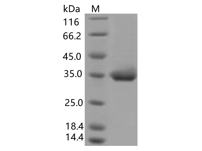 Recombinant SARS-CoV-2 Spike RBD(E484K)(His Tag) - image 1
