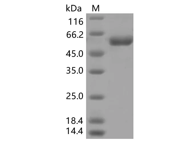 Recombinant SARS-CoV-2 Spike RBD (K417T)(rFc Tag) - image 1