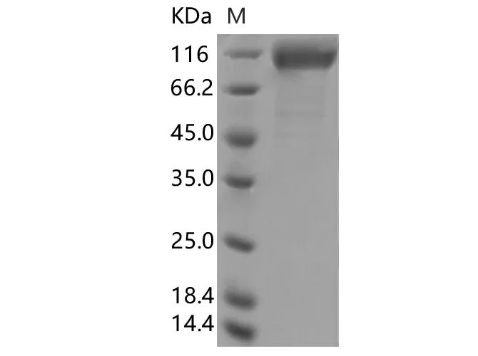 Recombinant SARS-CoV-2 Spike S1(ΔHV69-70, Y453F, D614G)(His Tag) - image 1