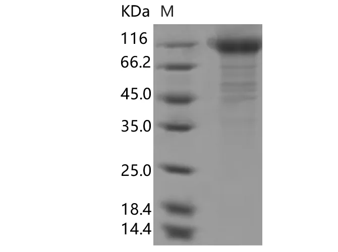 Recombinant SARS-CoV-2 Spike S1(N234Q)(His Tag) - image 1