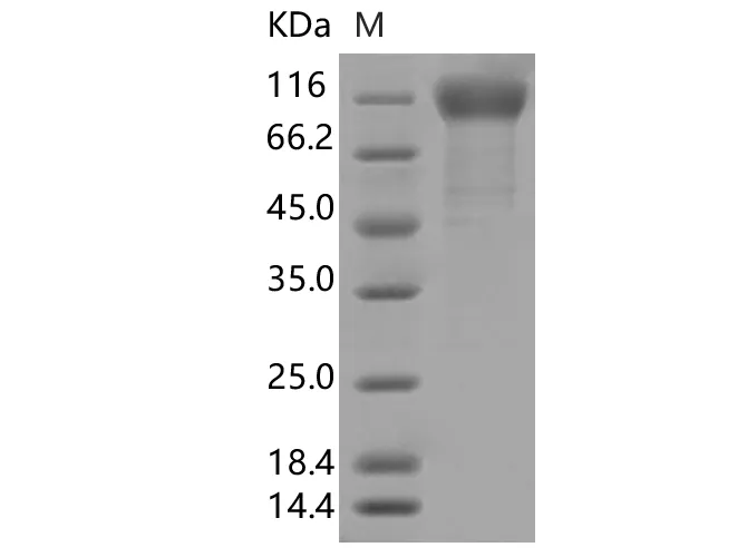 Recombinant SARS-CoV-2 Spike S1 (Q677H)(His Tag) - image 1