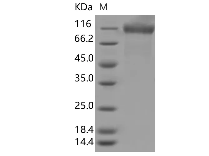 Recombinant SARS-CoV-2 Spike S1(L18F, D614G)(His Tag) - image 1