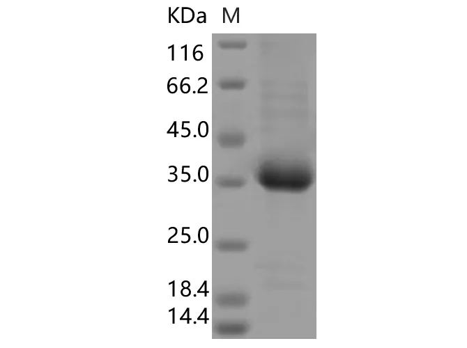 Recombinant SARS-CoV-2 Spike RBD(V503F)(His Tag) - image 1