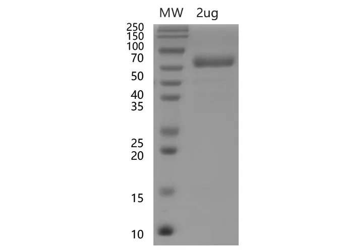 Recombinant SARS-CoV-2 Spike RBD Protein (C-hFc Tag)(Omicron) - image 1