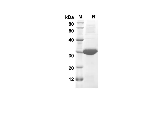 Recombinant Rat CXCL7 Protein(Trx Tag) - image 1