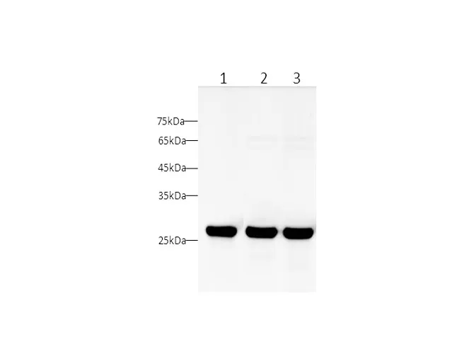 UCHL1 Polyclonal Antibody - image 1