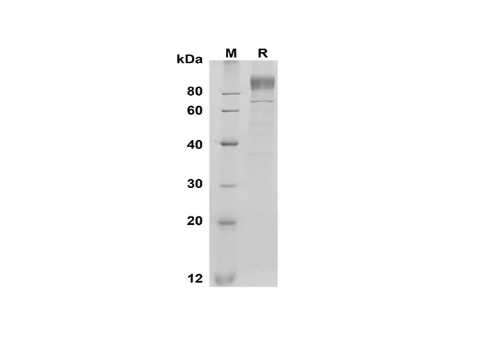Recombinant Mouse G-CSF R/CD114 Protein(His Tag) - image 1