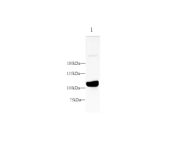 PSMA Polyclonal Antibody - image 1